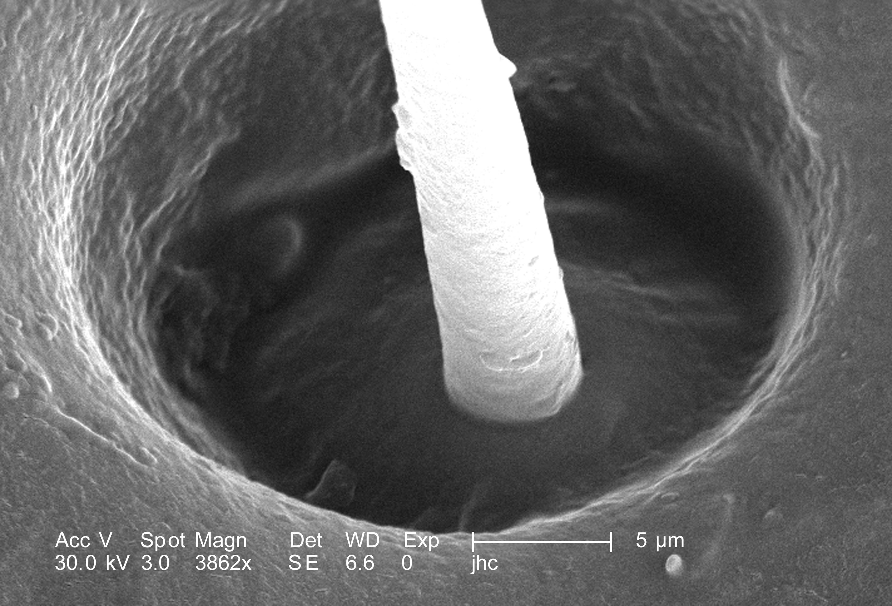 microscopic image of hair